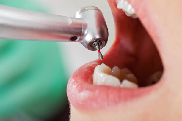 Best Emergency Orthodontic Repairs in West Menlo Park, CA